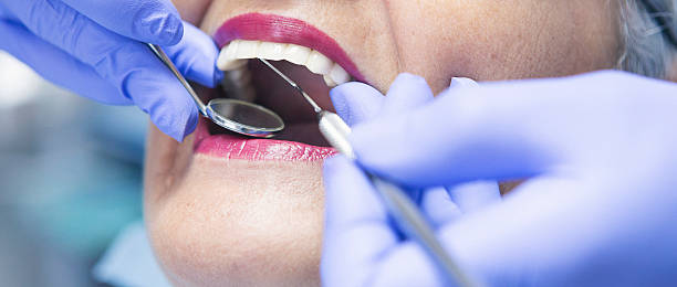 Best Emergency Root Canal Treatment in Overland, MO